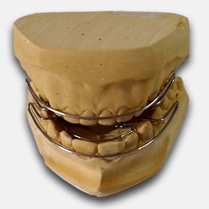 Ortodoncia Funcional